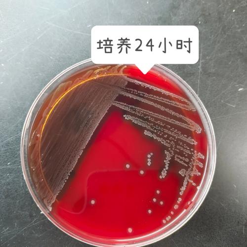 科学家运用机械进修让耐药检测更高效_链球菌_表型 互联网 科学家运用机械进修让耐药检测更高效_链球菌_表型 科学家运用机械进修让耐药检测更高效_链球菌_表型 互联网