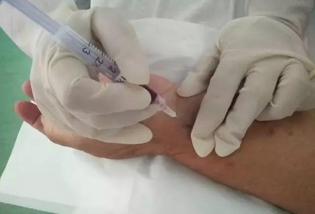 扎针神器!扎针不用愁:让血管清晰可见_血管_模式 智能 扎针神器!扎针不用愁:让血管清晰可见_血管_模式 扎针神器!扎针不用愁:让血管清晰可见_血管_模式 智能
