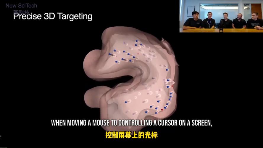 去除头骨植入芯片！马斯克脑机接口实验开始招人你敢不敢介入？_暗记_技巧 去除头骨植入芯片！马斯克脑机接口实验开始招人你敢不敢介入？_暗记_技巧 科学