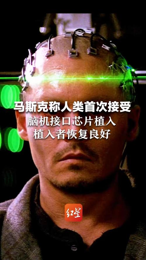 脑机接口芯片植入大年夜脑 马斯克的“心灵感应”灵不灵_接口_暗记 脑机接口芯片植入大年夜脑 马斯克的“心灵感应”灵不灵_接口_暗记 通讯